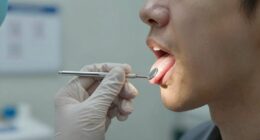 efficient taste change diagnosis